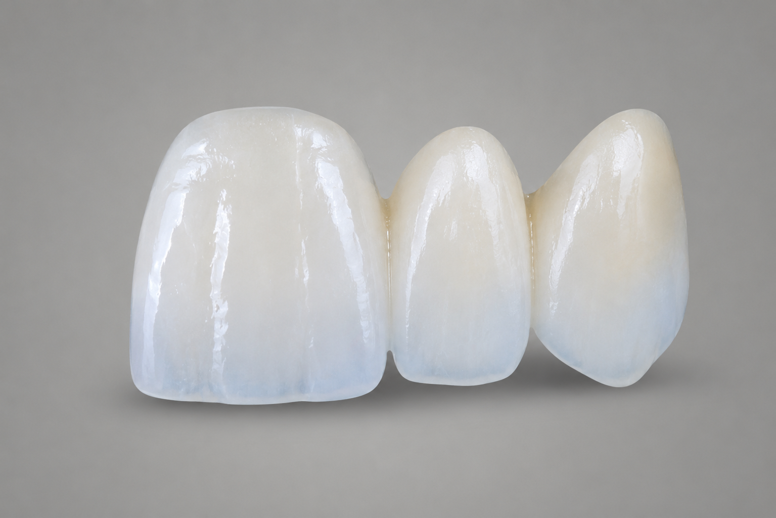 Corona Zirconio Multicapa